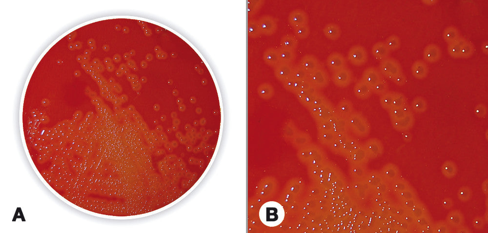 Blutagar (Basis), für die Mikrobiologie (500 g)